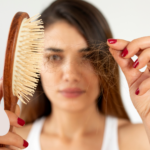 hormonal hair loss women South Africa