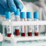 how to get hormones tested South Africa