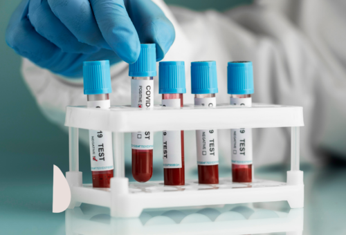 how to get hormones tested South Africa